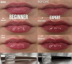 VT Cosmetics Reedle Shot customer photo 2 of 5