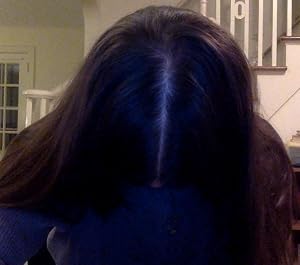 Rogaine Women’s 5% Minoxidil Foam customer photo 5 of 5