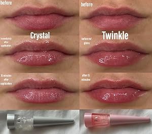 VT Cosmetics Reedle Shot customer photo 3 of 5