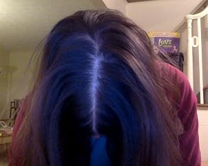 Rogaine Women’s 5% Minoxidil Foam customer photo 2 of 5