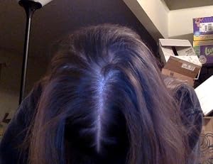 Rogaine Women’s 5% Minoxidil Foam customer photo 1 of 5